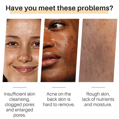 Turmeric Essentials™