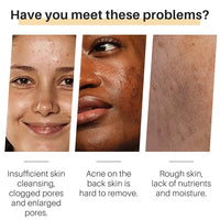 Turmeric Essentials™